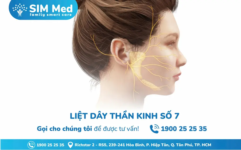 liet-day-than-kinh-so-7-liet-mat