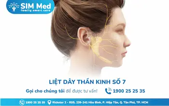 liet-day-than-kinh-so-7-liet-mat