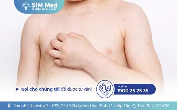 soi-cach-nhan-biet-va-phong-tranh