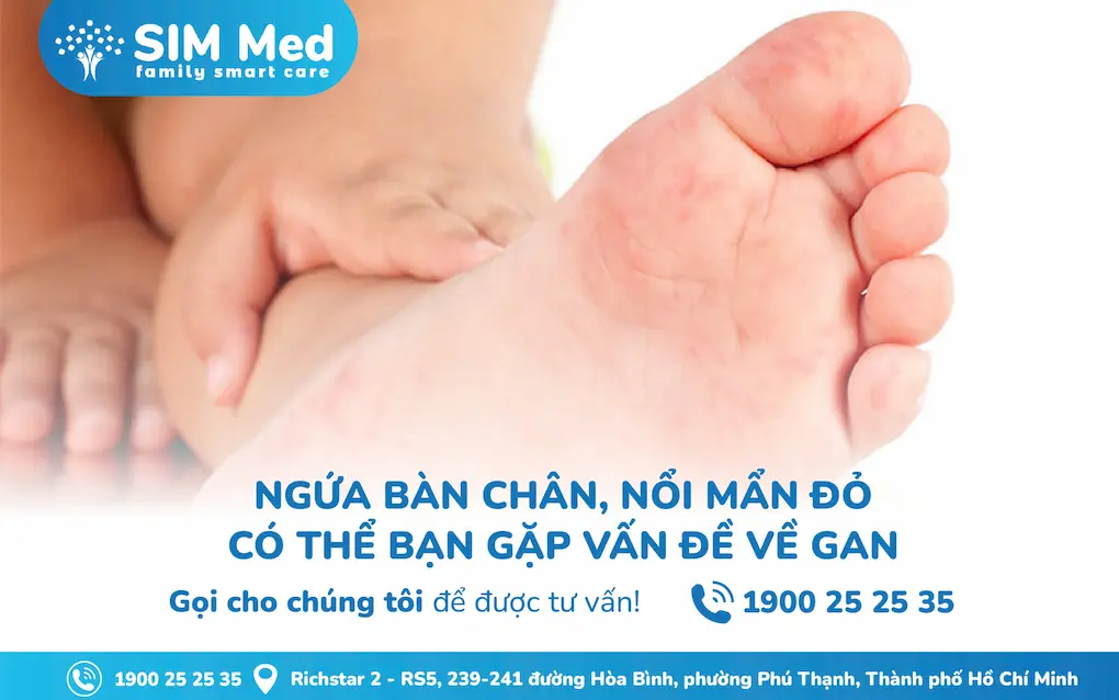 roi-loan-chuc-nang-gan-u-mat-dau-hieu-nhan-biet-va-cach-phong-ngua-hieu-qua