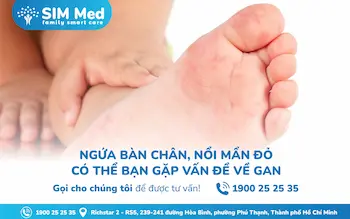 roi-loan-chuc-nang-gan-u-mat-dau-hieu-nhan-biet-va-cach-phong-ngua-hieu-qua