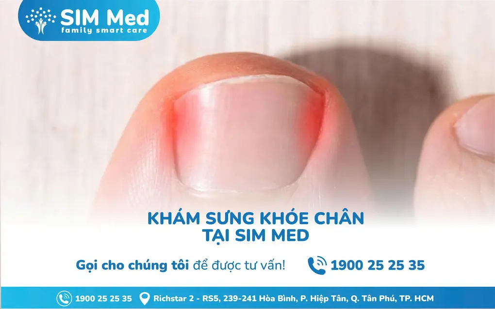 kham-sung-khoe-chan-nguyen-nhan-trieu-chung-cach-dieu-tri