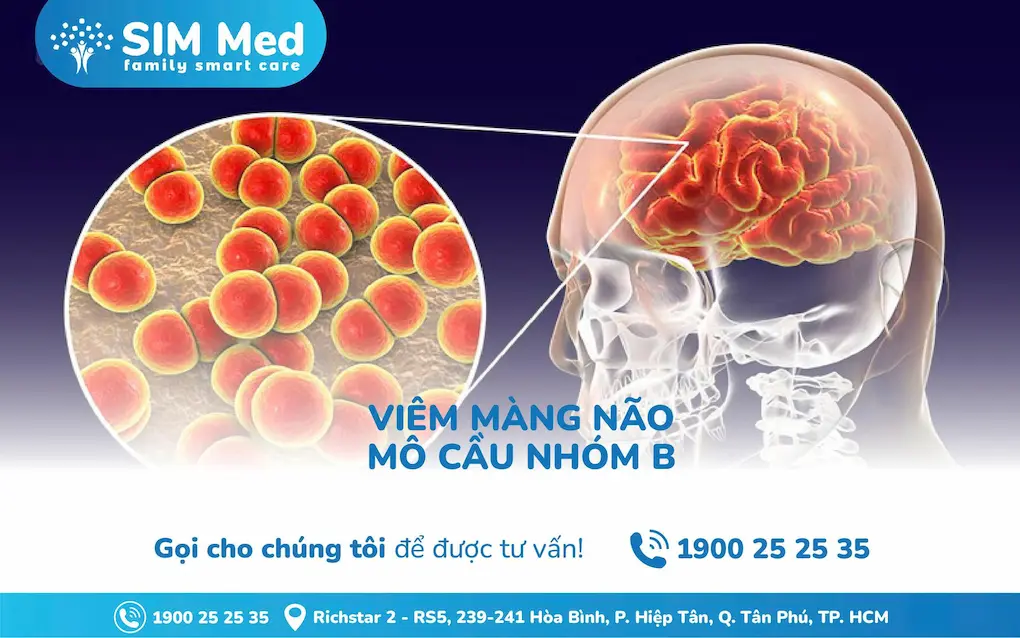 viem-mang-nao-mo-cau-nhom-b-trieu-chung-nguyen-nhan-phong-ngua