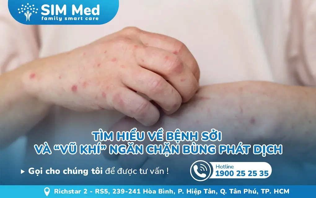benh-soi-va-vu-khi-ngan-chan-bung-phat-dich