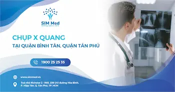 chup-x-quang-o-quan-binh-tan-quan-tan-phu