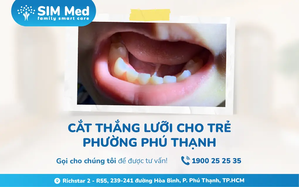 cat-thang-luoi-cho-tre-phuong-phu-thanh