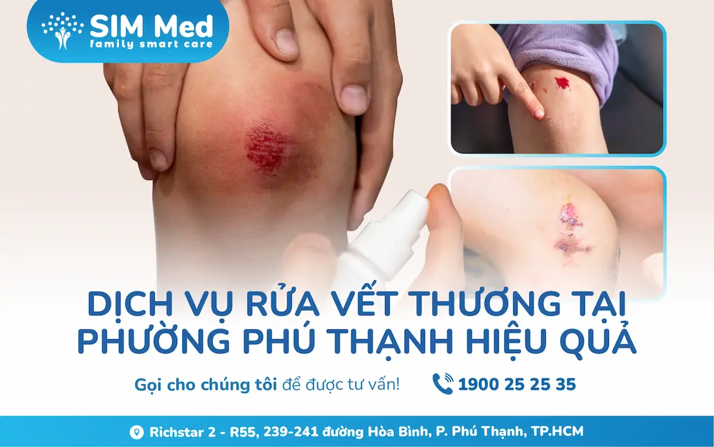 dich-vu-rua-vet-thuong-tai-phuong-phu-thanh