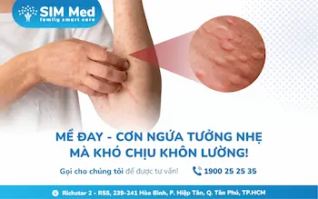 benh-me-day-anh-huong-nguyen-nhan-va-dieu-tri