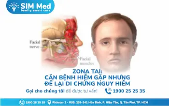 zona-tai-can-benh-hiem-gap-nhung-de-de-lai-di-chung-nguy-hiem