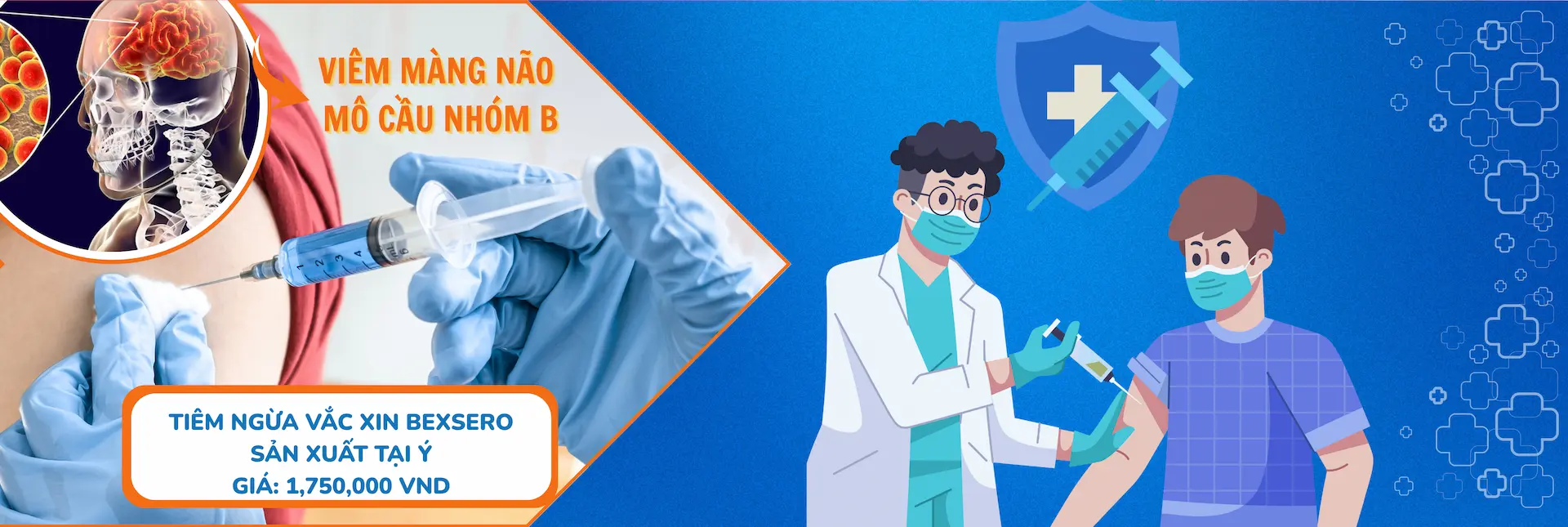 Viêm màng não mô cầu nhóm B